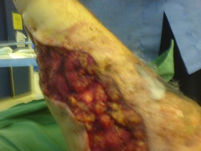 Arm 1.jpg