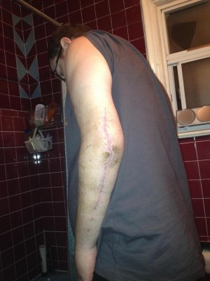 Well here is my arm (.jpg