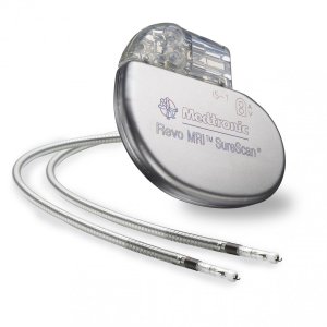 Pacemaker.jpg