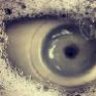 CatheteriZedEYE